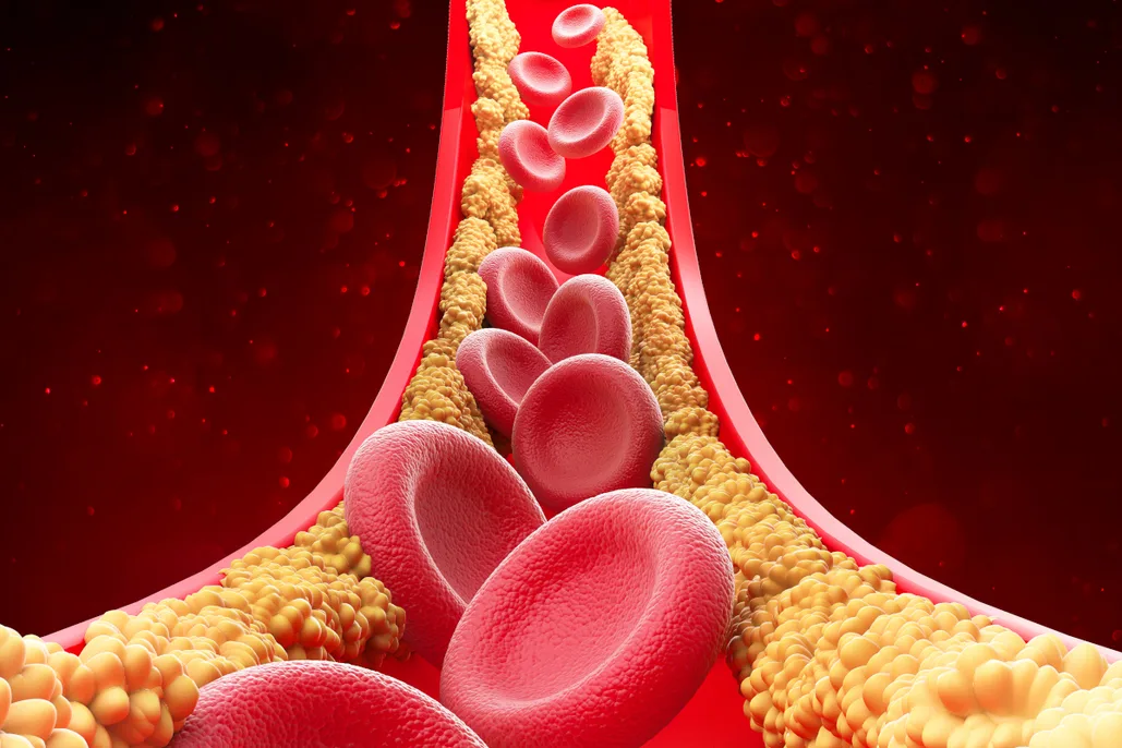 Homeopathic remedies for High Cholesterol and lipid metabolism regulation
